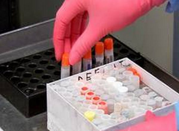 Black Fungus Cases in India: Govt Allocates Additional 2,12,540 Vials of Amphotericin-B to States, Union Territories