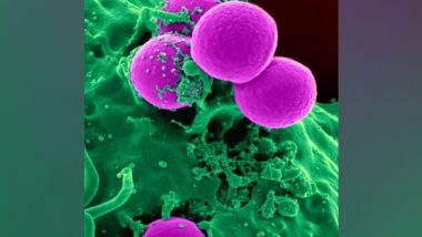 Health News | Research Provides Roadmap to HIV Eradication Via Stem Cell Therapy