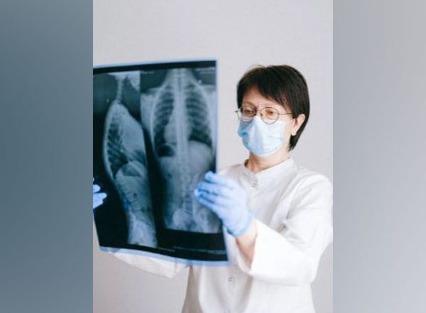 Health News | Study Shares Tips to Protect Lungs from Damaged Caused by TB