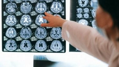 Health News | Newly Discovered Stem Cell Resting Phase Could Put Brain Tumours to Sleep