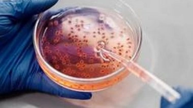 Health News | Loss of Circadian Regulation Allows for Increase in Glucose Production During Lung Cancer