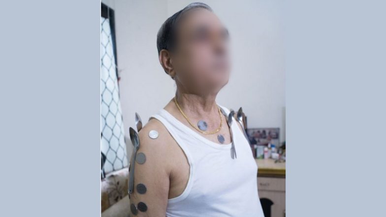 COVID-19 Vaccine, RT-PCR Test Make Your Body Magnetic? Metal Objects Getting Attached to Nashik Man's Torso, Health Officials Say No Correlation With Vaccination
