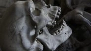 Science News | Brain, Spinal Cord Are Protected by Immune Cells from Skull's Bone Marrow: Study