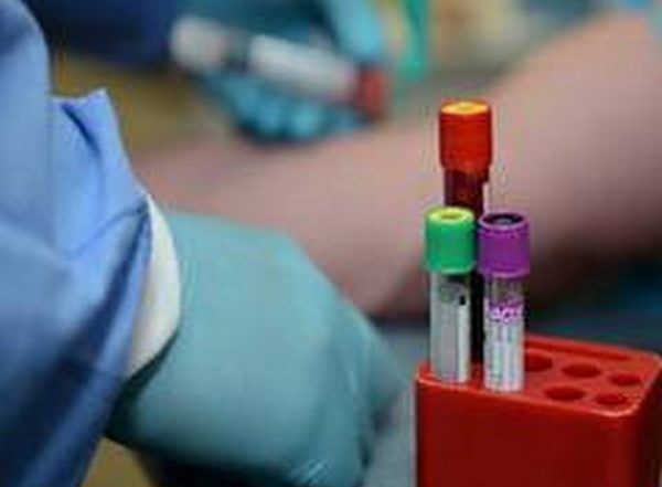 Chinese Researchers Find Batch of New Coronaviruses in Bats: Report