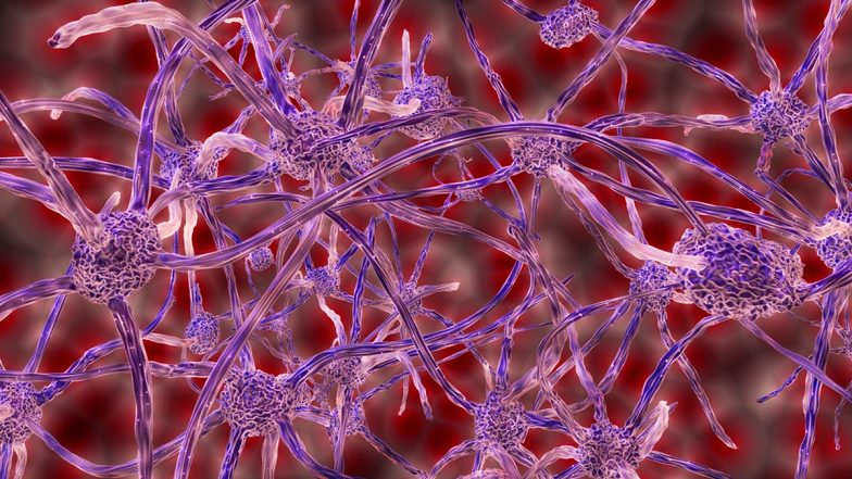 What is Guillain-Barré Syndrome? From Symptoms to Causes, Here is Everything You Need to Know About The Autoimmune Neurological Disorder