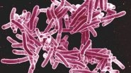 Health News | Researchers Develop New Cell-analysis Technique to Fight Tuberculosis