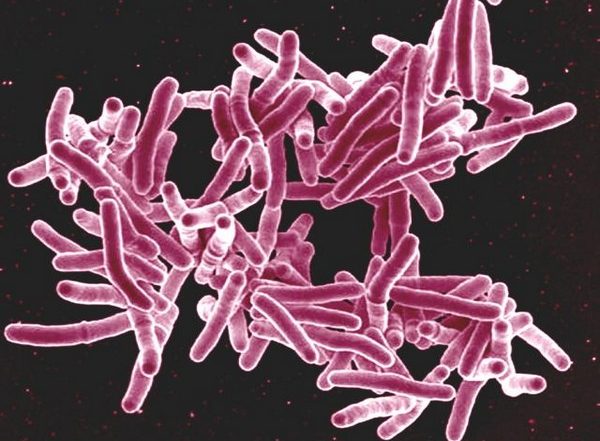 Health News | Researchers Develop New Cell-analysis Technique to Fight Tuberculosis