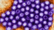 Norovirus Outbreak in United Kingdom: What is Norovirus? From Symptoms to Spread of 'Vomiting Bug', All You Need to Know About Highly Contagious Infection