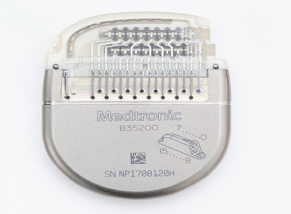 Business News | Medtronic Launches Percept™ PC - The First and DBS System with BrainSense Technology for Movement Disorders Like Parkinson's and Epilepsy