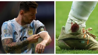 Lionel Messi Played with a Bleeding Ankle in the Second Half Against Colombia, Copa America 2021 Semi-Finals, Pics go Viral