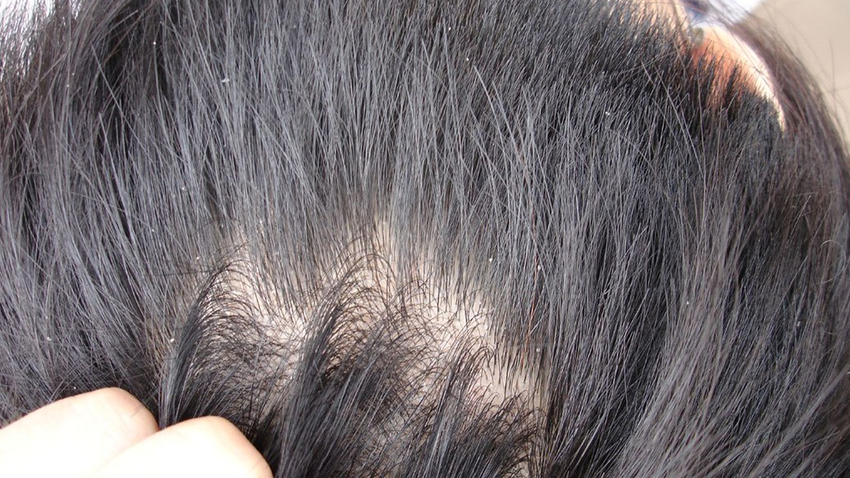 У вьетнамских свиней выпадают волосы что это