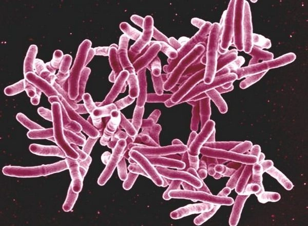Science News | Study Finds Surprising New Way on How Tuberculosis Suppresses Immunity