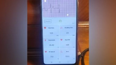 Business News | MedAchievers' 'Smart ICU' to Help Doctors Monitor Patients from Distance: May Help in COVID Like Situation