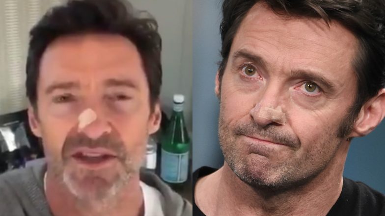 Hugh Jackman Confirms His Diagnosis Being Inconclusive, Says ‘Worst It Can Be Is a Basel Cell Carcinoma’ (Watch Video)