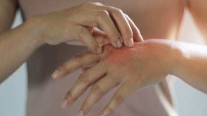 Light Therapy Helps Burn Injuries Heal Faster, Finds Study