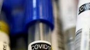 World News | Daily Increase in COVID-19 Cases in Turkey Nears 25,000, Maximum for 3 Months
