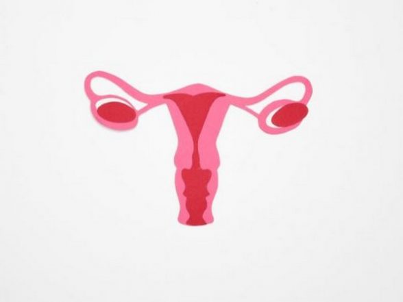 Potential Therapeutic Target Identified for Ovarian Cancer