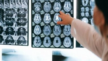 Science News | Researchers Discover Potential to Reverse Ageing in Brain