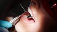 Health News | Demand for Teeth Whitening in India Increased in Past Decade