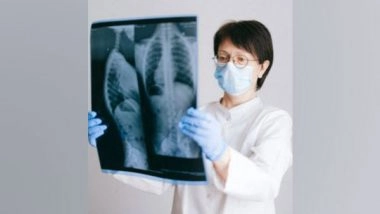 Science News | Potential Biomarker for Lung Disease in Scleroderma Patients Discovered