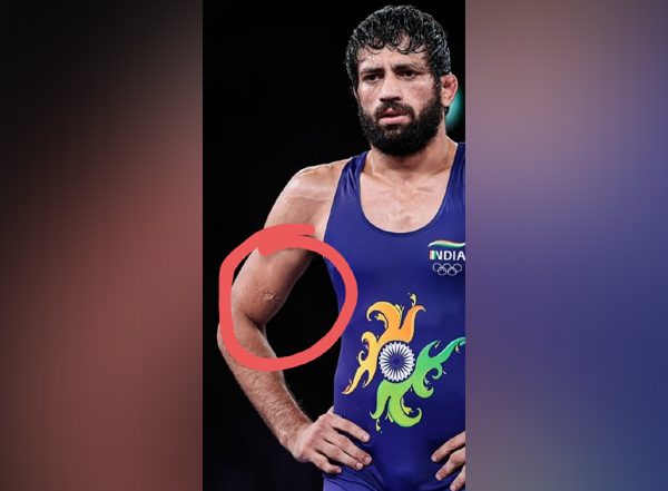 Sports News | Tokyo Olympics: Nurislam Sanayev Bites Ravi Dahiya During Semi-final Clash, Sehwag Labels Act 'disgraceful'