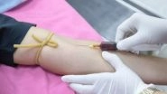 Health News | Red Blood Cell Alterations Contribute to Lupus: Study