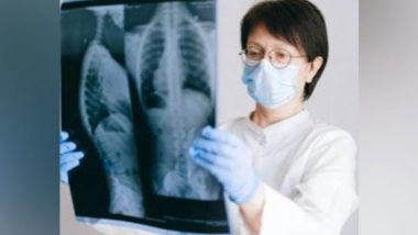 Health News | Study Finds How Persistent Lung Disease Develops Long After the Virus Has Been Cleared