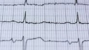 Health News | Researchers Find Combination Therapy Cuts Risk of Heart Attacks, Strokes in Half