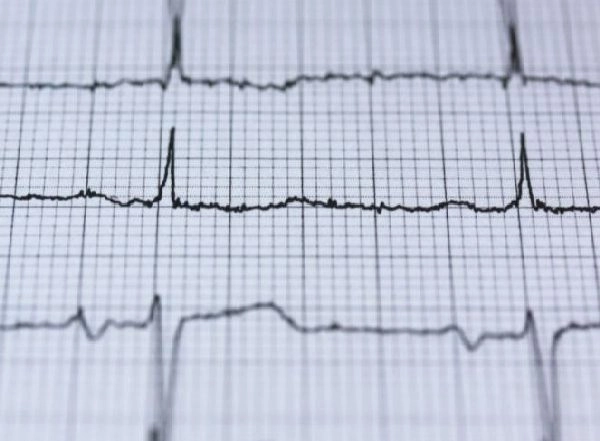 Health News | Researchers Find Combination Therapy Cuts Risk of Heart Attacks, Strokes in Half