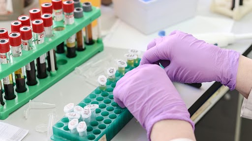 Scrub Typhus Spread Reported in UP’s Mathura District, All You Need To Know About The Symptoms, Causes of the Mite-Borne Rickettsiosis