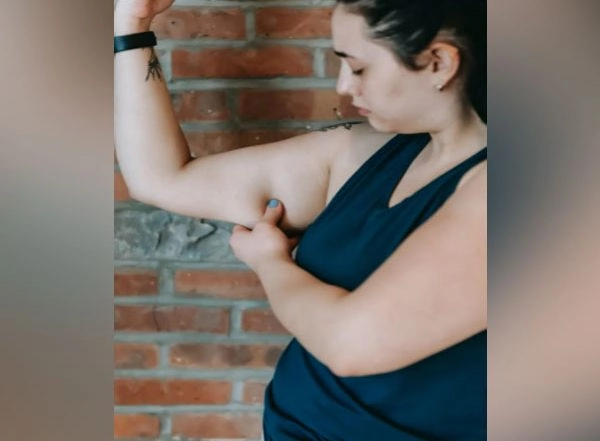 Health News | Study Finds Being Overweight Can Cause Depression