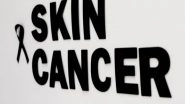 Health News | New Insights into Fundamental Workings of Immune System in Response to Skin Cancer Therapy