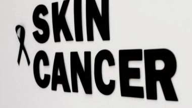 Health News | New Insights into Fundamental Workings of Immune System in Response to Skin Cancer Therapy