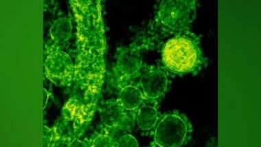 Health News | Study Reveals That Immune Cells Cooperate to Kill Bacteria