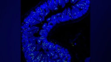 Science News | New Discovery About Immune 'sentinel' Cells May Aid Cancer Treatment