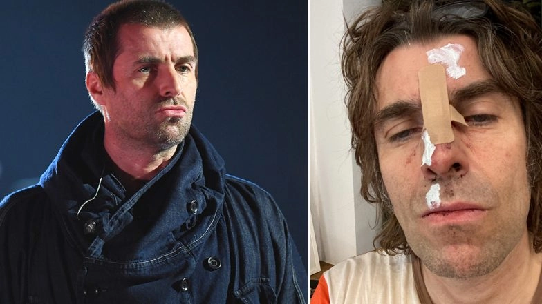 Liam Gallagher Cancels Belfast Gig After Falling Out From a Helicopter at IOW Festival