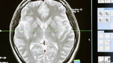 Science News | Scientists Discover New Brain Cells Responsible for Controlling Movement