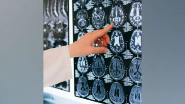 Science News | Neuroscientists Roll out First Comprehensive Atlas of Brain Cells