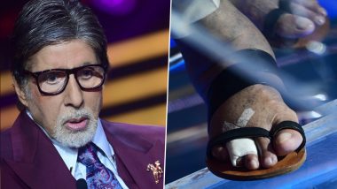 Kaun Banega Crorepati 13: Amitabh Bachchan Shows His Fractured Toes on Sets of the Show