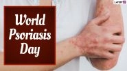 World Psoriasis Day 2021: Foods That Can Trigger the Skin Disease