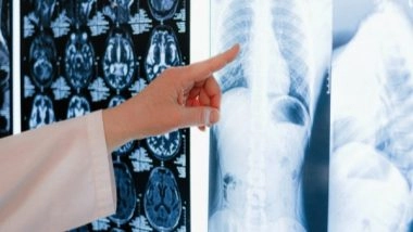 Science News | Researchers Attempt Better Understanding of Cystic Fibrosis