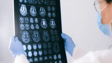 Science News | Researchers Find Promising Results for Parkinson's Disease Treatment