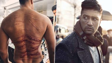 Sardar Udham Actor Vicky Kaushal Lauds Prosthetic Makeup Artist Peter Gorshenin For Making Those Scars Look Real