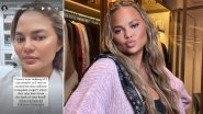 Chrissy Teigen Responds to Backlash for Posting About Eyebrow Transplants, Says &lsquo;WHY Are People So F&mdash;Ing Riled Up Over Any Little Thing I Do?&rsquo;