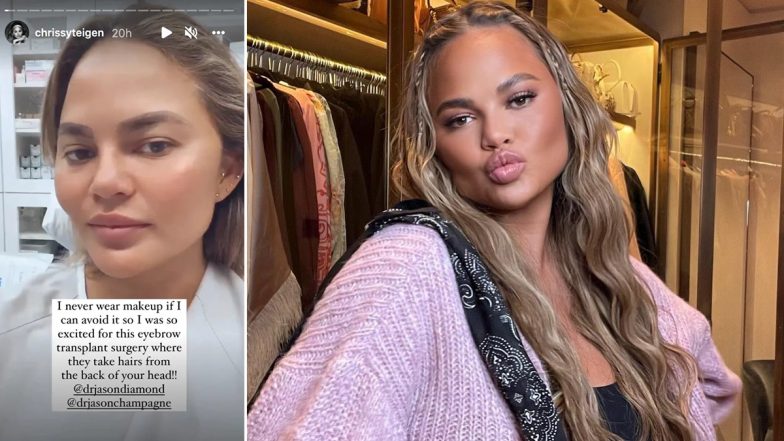 Chrissy Teigen Responds to Backlash for Posting About Eyebrow Transplants, Says ‘WHY Are People So F—Ing Riled Up Over Any Little Thing I Do?’