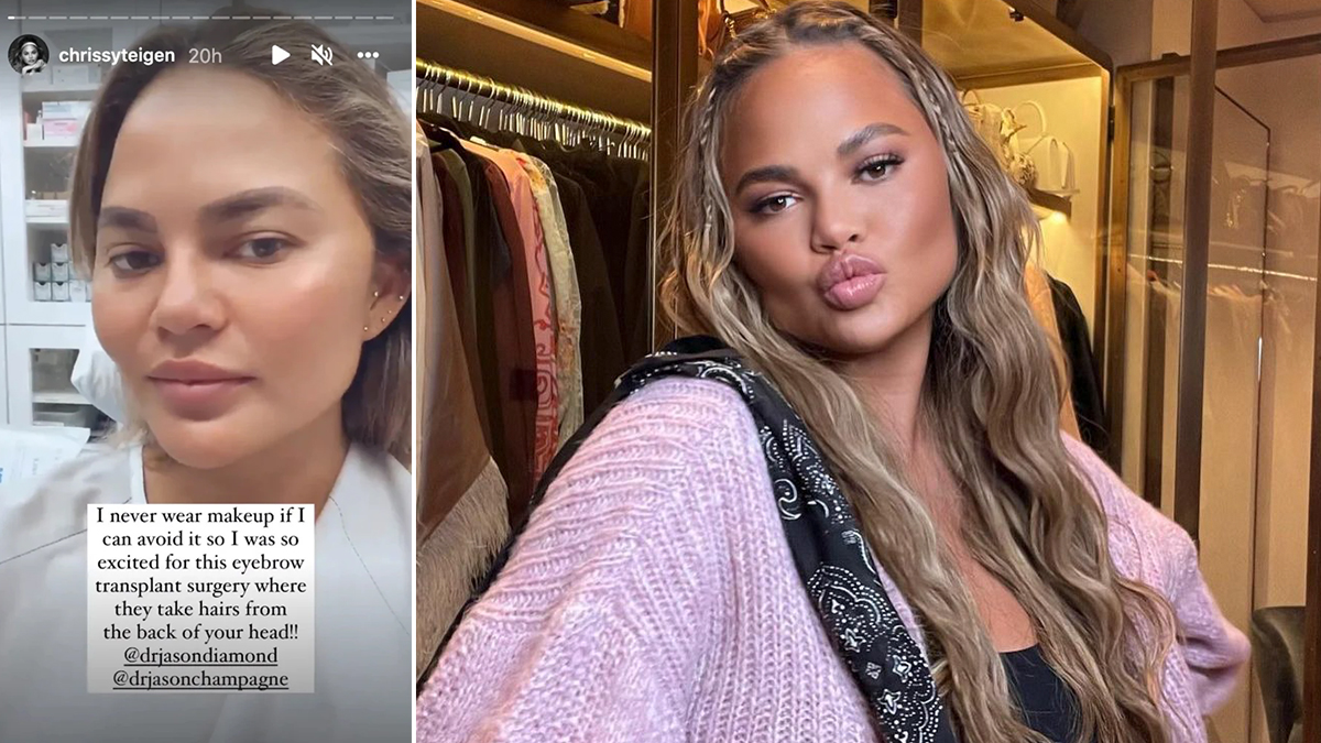 Hollywood News ‘why Are People So Riled Up Says Chrissy Teigen Over Eyebrow Transplants 