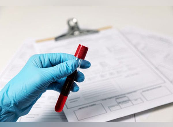 EMM Negative: Gujarat Man Identified With India's First And World's Tenth Unique Blood Group