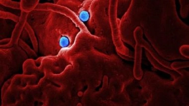 Health News | COVID-19 Pandemic Associated with Disruptions to Women's Reproductive Health: Study