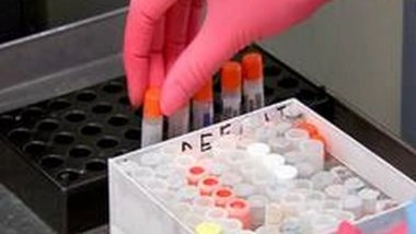 World News | COVID-19 Cases Rise to 5,06,816 in Myanmar