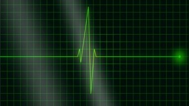 Health News | Study Finds Only Alcohol Triggers Heart Arrythmia